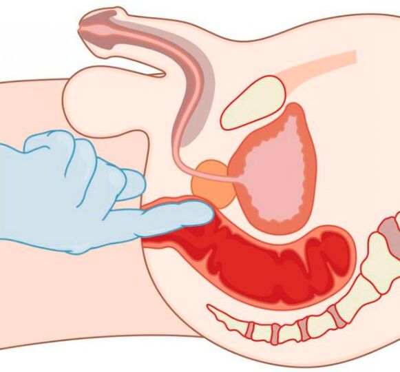 Stimolazione del punto G negli uomini attraverso l'ano