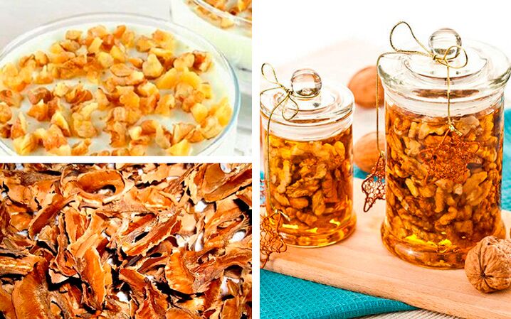Ricette delle persone